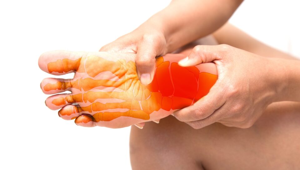 inflamed plantar fasciitis foot held by man